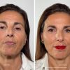 Ampolletas Faciales Flash Effect | LaCabine