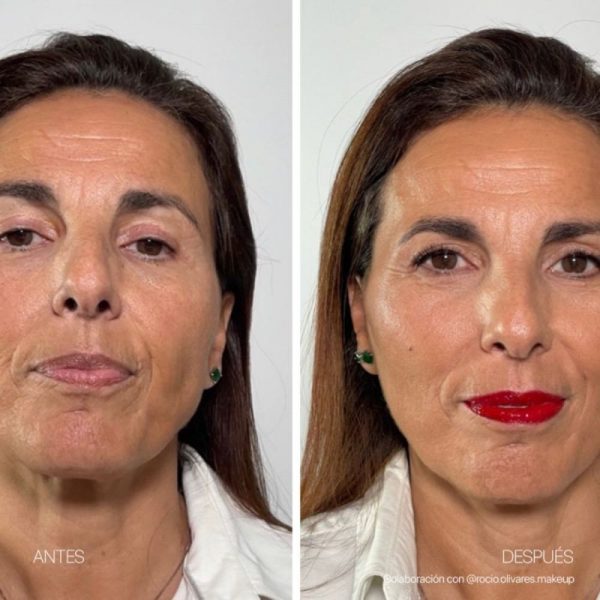 Ampolletas Faciales Flash Effect | LaCabine